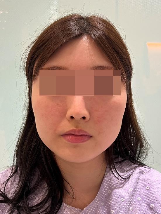 인간의 얼굴, 사람, 입술, 눈썹이(가) 표시된 사진
자동 생성된 설명